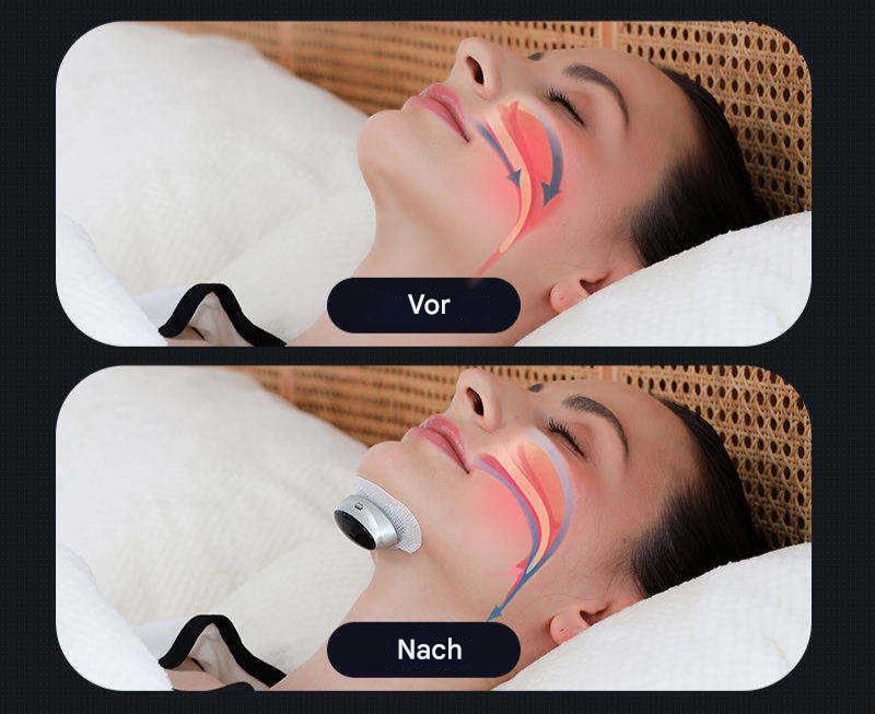 Detailansicht der AirEase Schlafapnoe-Hilfe aus flexiblem Silikon für angenehmen Sitz & freie Atemwege beim Schlaf.