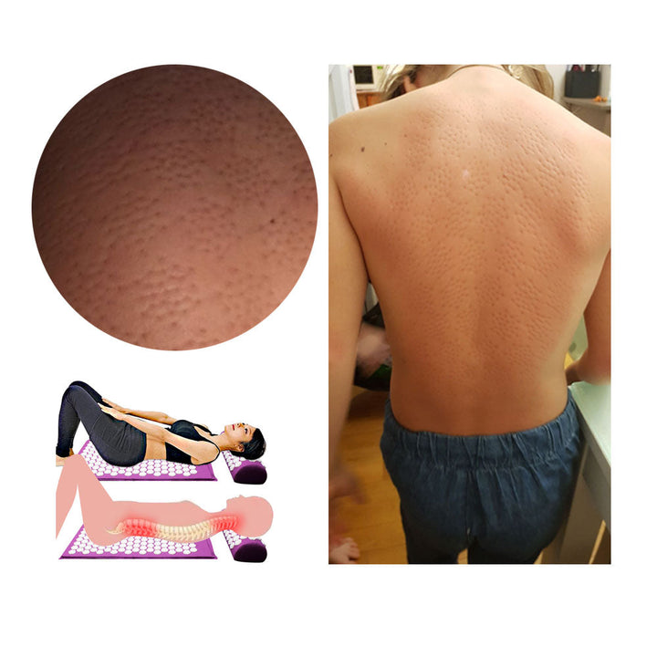 Akupressur-Kissen für Nacken- & Kopf-Massage, unterstützt Tiefenentspannung & Stressabbau.