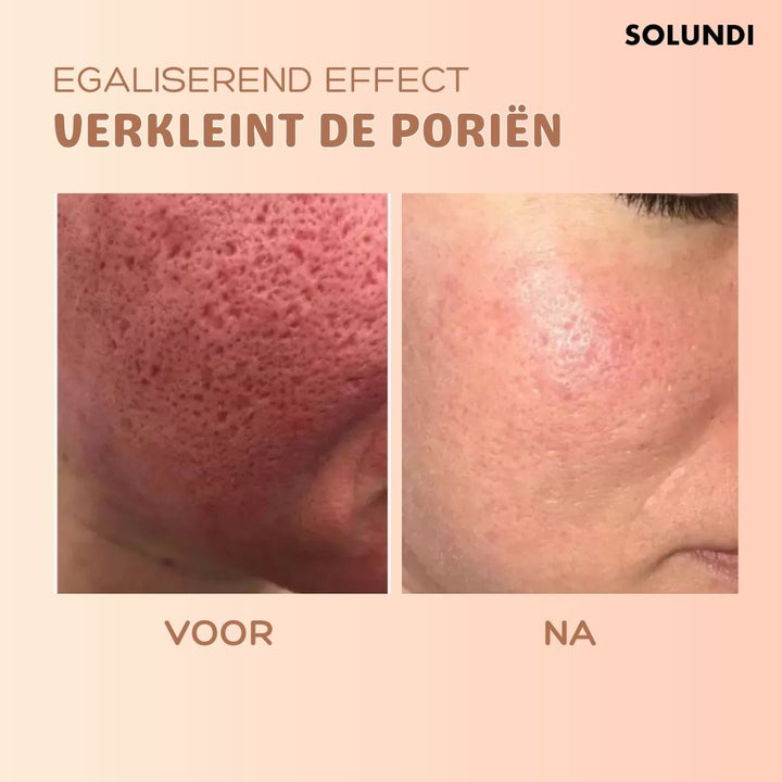 Schneller Anti-Falten Balsam für das Gesicht. Reduziert Falten, spendet Feuchtigkeit und sorgt für strahlenden Teint.