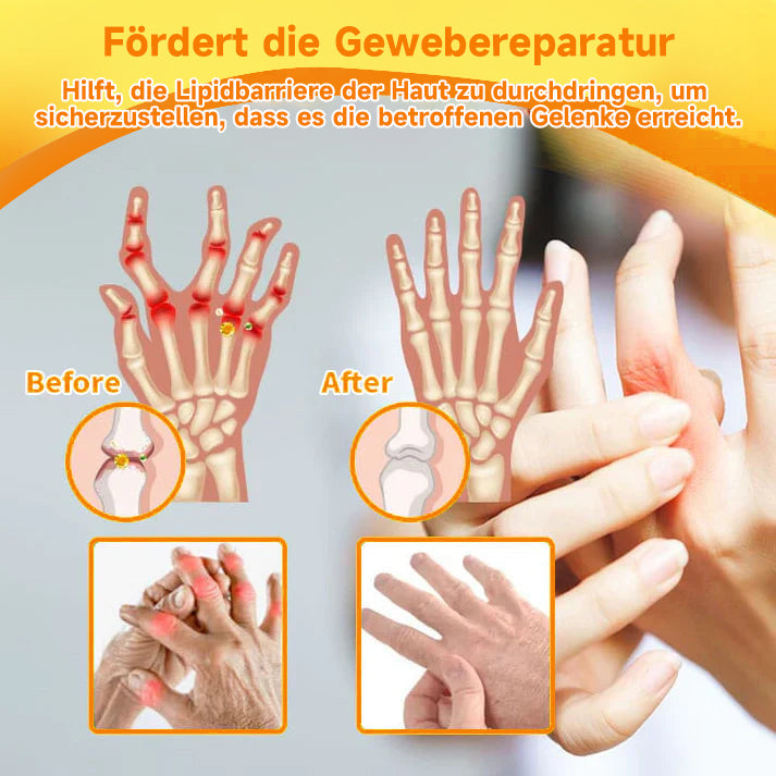 Hochwirksame Vitalcreme gegen Gelenkschmerzen und Muskelschmerzen, fördert die Beweglichkeit.