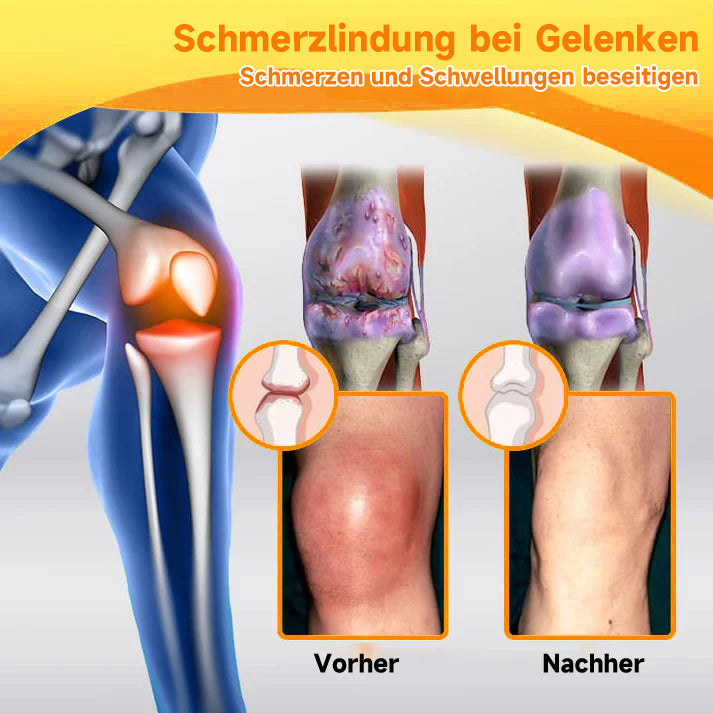 Schnelle Linderung von Gelenk- & Muskelschmerzen mit der Bienen-Vital-Creme.