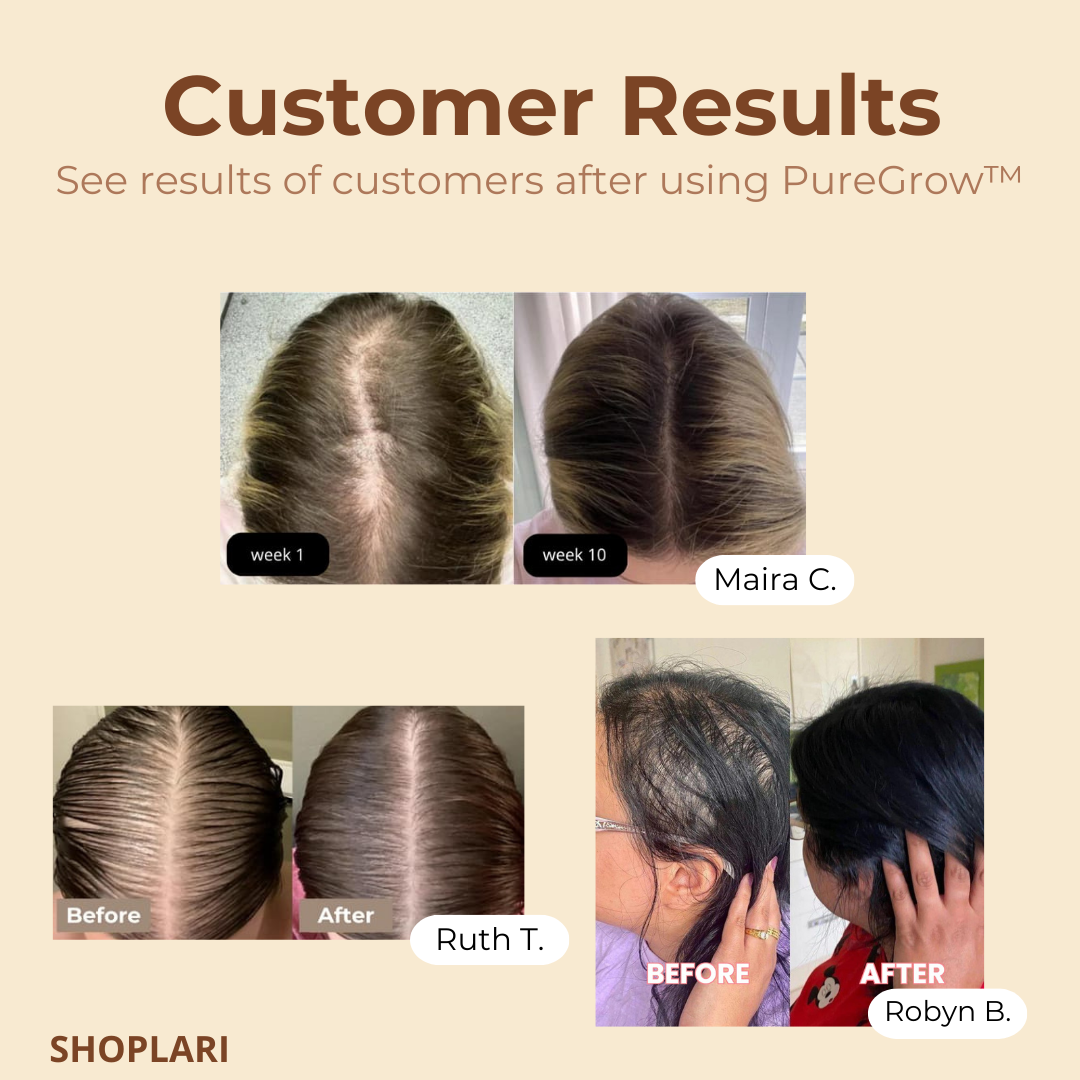 Glänzendes, kräftiges Haar dank Bio Batanaöl. Natürliche Haarpflege gegen Haarausfall & für Reparatur.