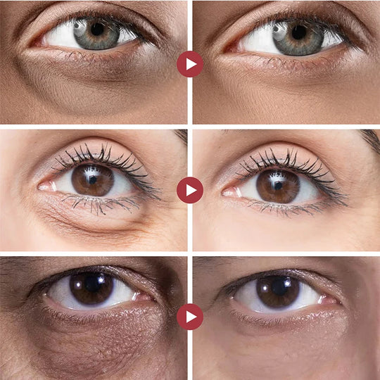 Hochwirksame Damen Augencreme für empfindliche Haut. Mindert Falten, strafft & hellt Augenringe auf.