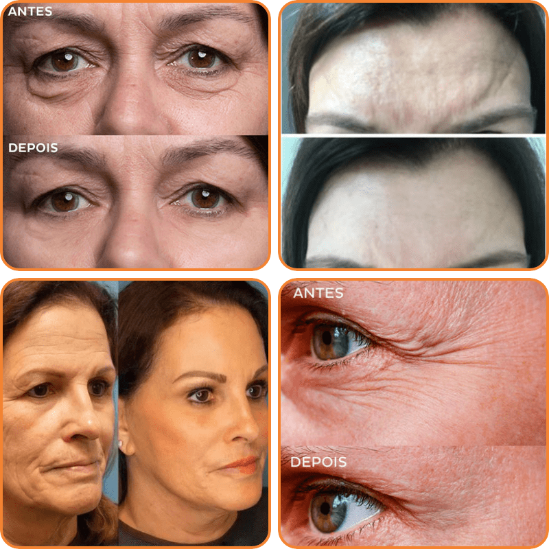 Kollagen & Hyaluronsäure: Inhaltsstoffe der Damen Anti-Aging Gesichtsmaske für intensive Feuchtigkeitspflege.