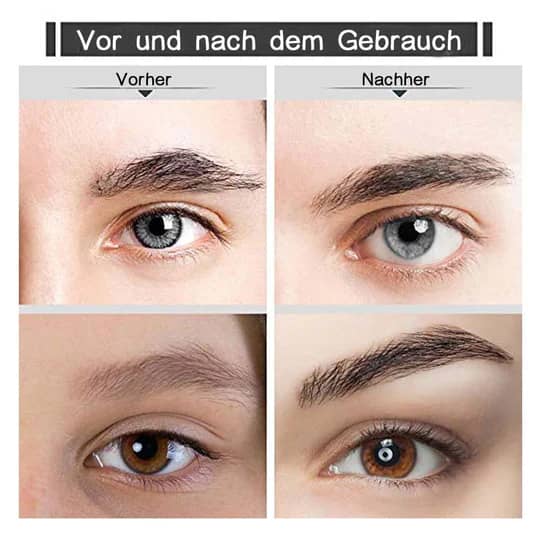 Präziser Augenbrauen Haarentferner für Frauen mit LED-Licht. Sanfte, effektive Entfernung unerwünschter Gesichtshaare.