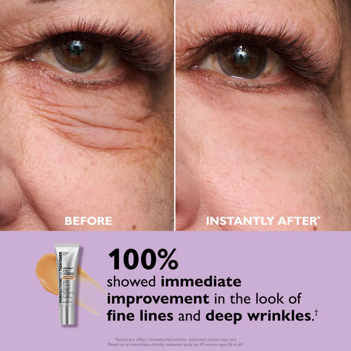 Frischer Blick nach Anwendung der Anti-Aging Augencreme. Reduziert Falten, mildert Augenringe, strafft die Haut.
