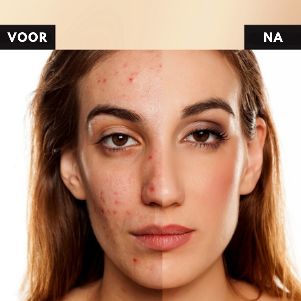Mattierender Damen Concealer, deckt Augenringe und Unreinheiten effektiv ab.