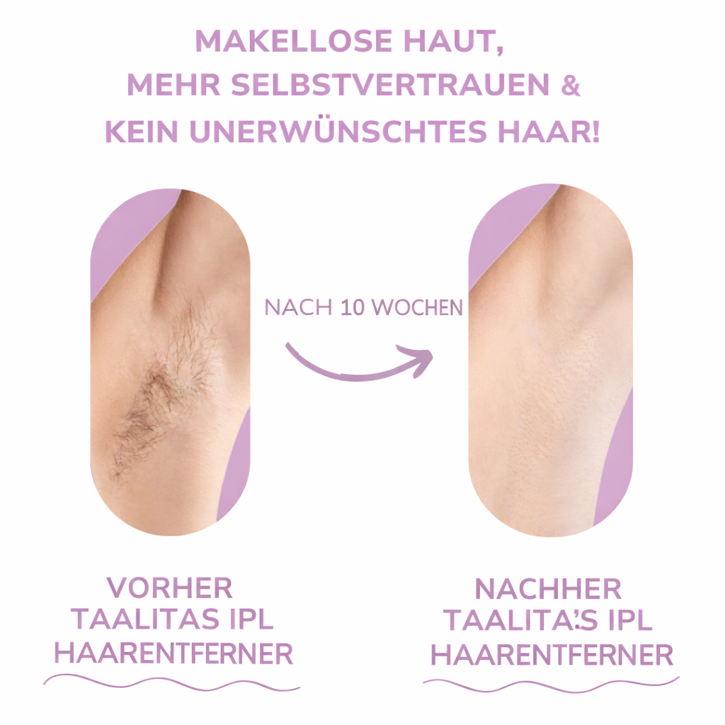 Hochwertiger IPL Epilierer für Damen. Effektive Haarentfernung mit IPL Technologie für seidig glatte Haut.