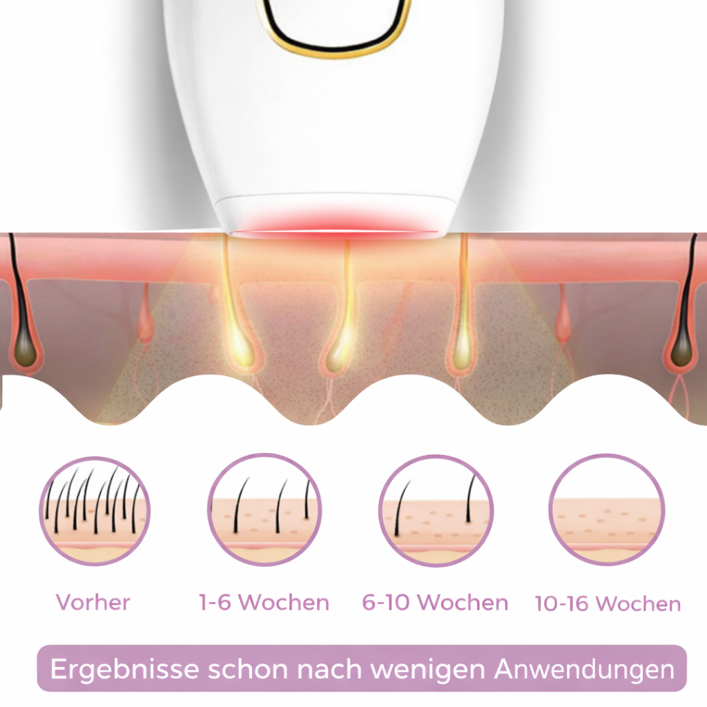 IPL Haarentferner für Damen mit ergonomischem Design. Sanfte Haarentfernung für Beine & Achseln.
