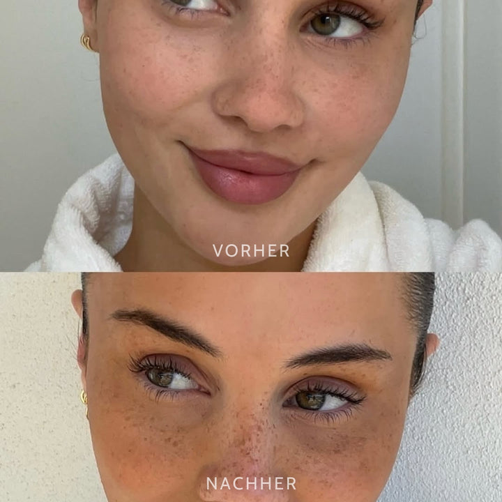 Moderner Beauty-Trend: Natürliche, künstliche Sommersprossen leicht gemacht mit unserem Freckles-Stempel.