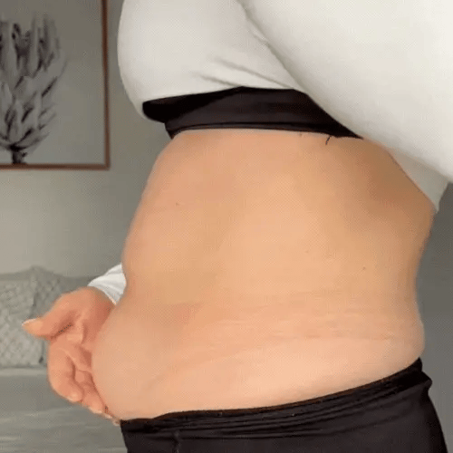 Effektives Damen Lifting-Pflaster für Oberschenkelstraffung, glättet die Haut sofort für eine schöne Körperkontur.