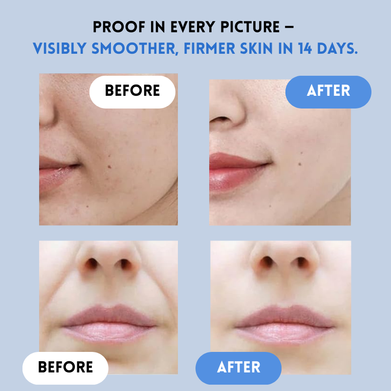 Unsichtbare Lifting-Pflaster für Damen. Schnelle Gesichtsstraffung, Hautstraffung & Faltenreduzierung mit Soforteffekt.