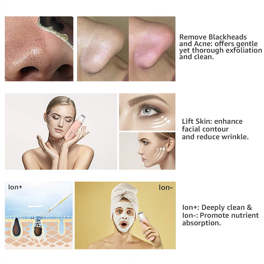 Effektiver Ultraschall-Porenreiniger für Damen, entfernt Mitesser, für klare Haut.