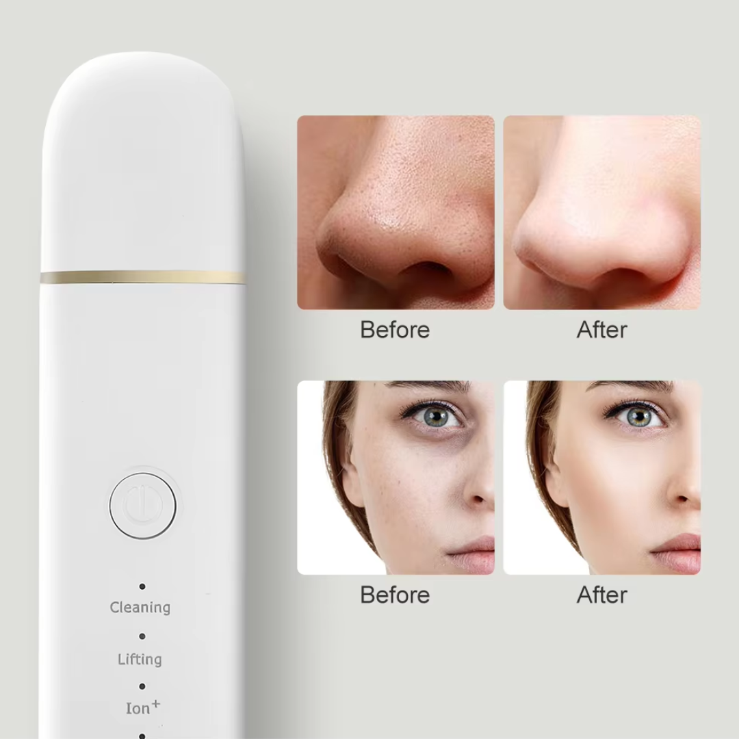 Sanfte Exfoliation & Hautbildverbesserung mit dem Damen Ultraschall-Hautscrubber für reine Haut.