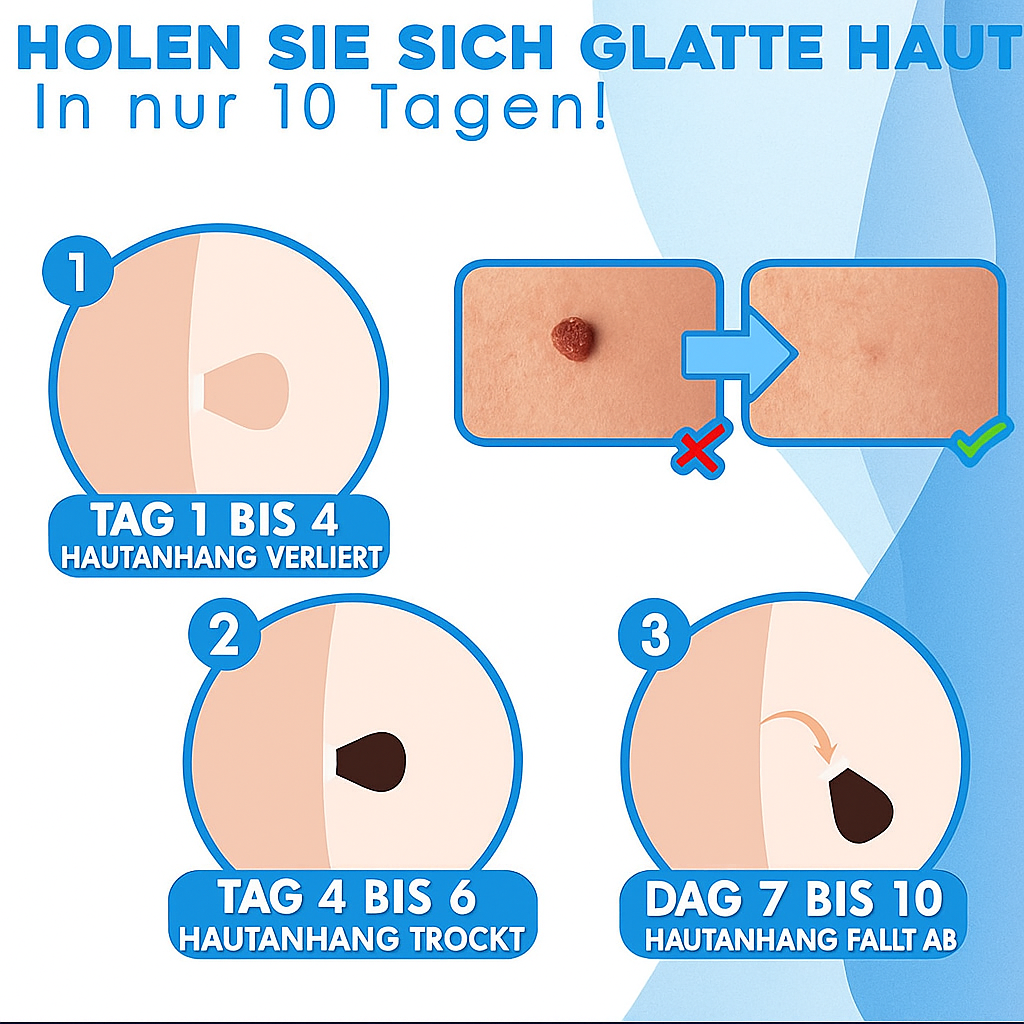 Warzenentferner-Produkt für Gesicht und Körper. Schmerzfreie Anwendung für sichtbar glatte Haut.