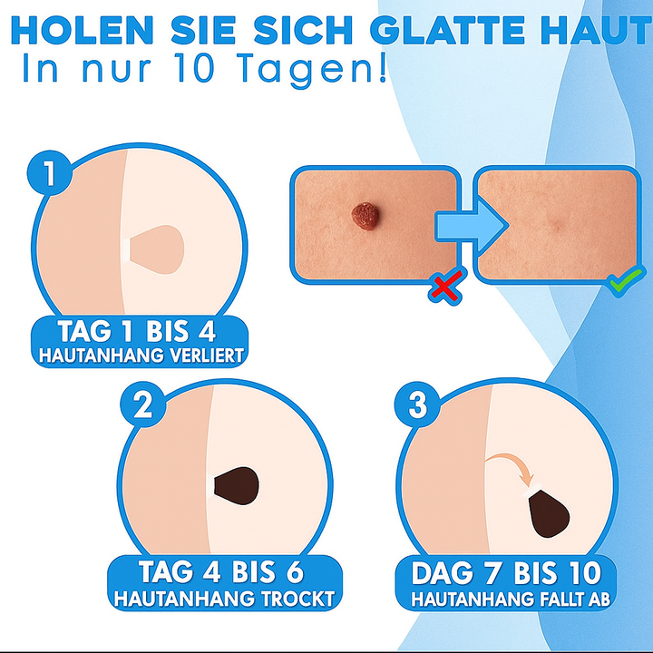 Warzenentferner-Produkt für Gesicht und Körper. Schmerzfreie Anwendung für sichtbar glatte Haut.