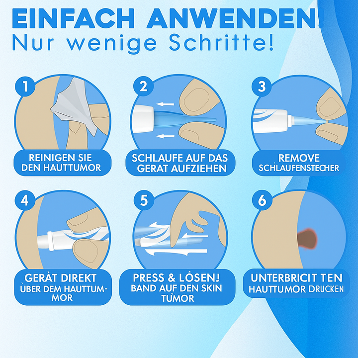 Premium Warzenentferner für schnelle, schmerzfreie Behandlung. Fördert seidig glatte Haut am ganzen Körper.