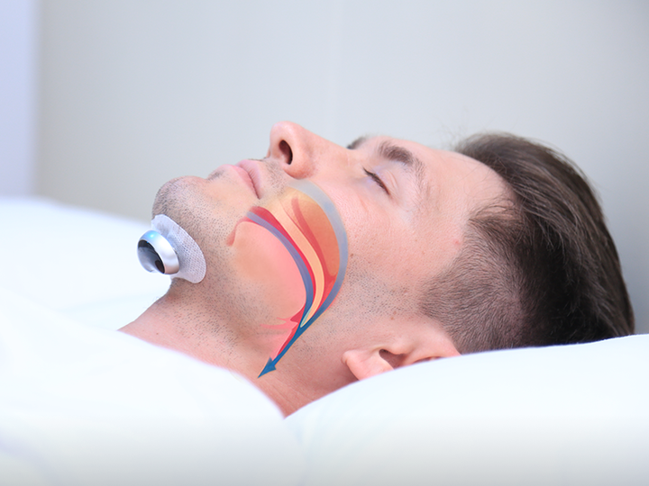 Ergonomisch designtes Anti-Schnarch-Gerät für maximalen Komfort und ungestörten, erholsamen Schlaf.