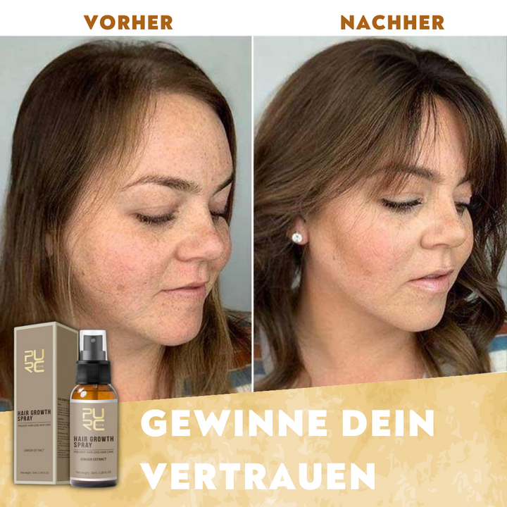 Dieses Haarwachstumsspray reduziert Haarausfall und sorgt für sichtbares Volumen bei dünnem Haar.