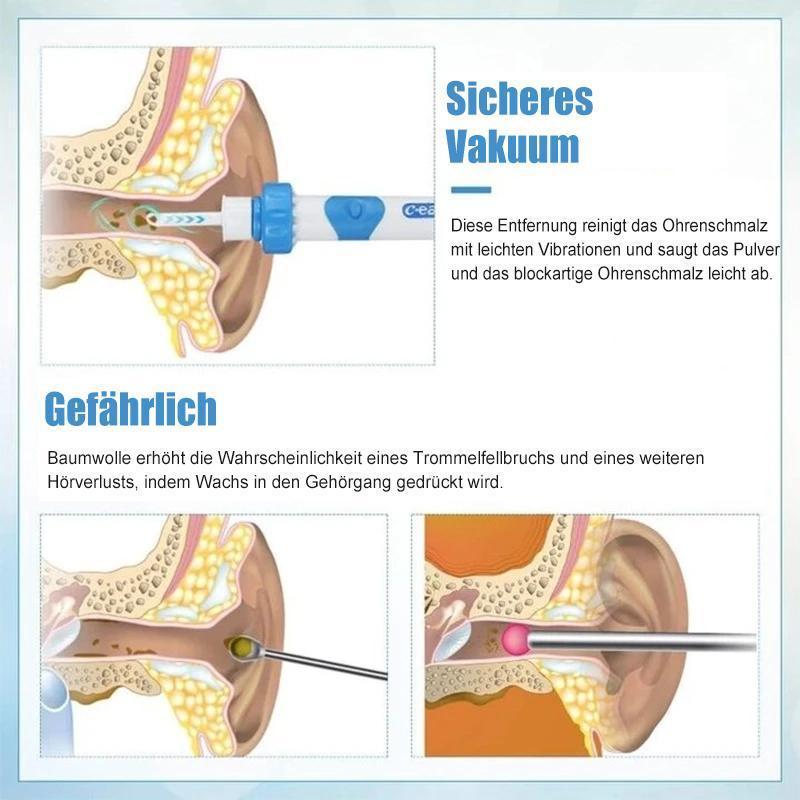 Saubere Ohren dank dem sanften elektrischen Ohrenschmalzentferner für optimale Ohrhygiene.
