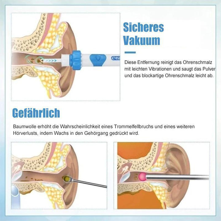 Saubere Ohren dank dem sanften elektrischen Ohrenschmalzentferner für optimale Ohrhygiene.