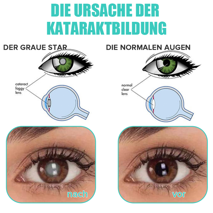 Erfrischende Augentropfen für Feuchtigkeit, klare Sicht und Komfort den ganzen Tag.