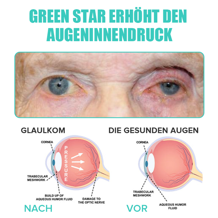 Flasche erfrischende Augentropfen, lindert Trockenheit, sorgt für klare Sicht und Wohlbefinden.