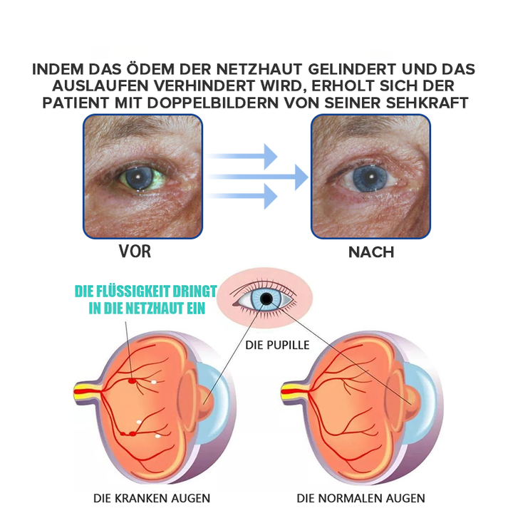 Sofort erfrischende Augentropfen für ein angenehmes Gefühl und verbesserte Sehkraft.