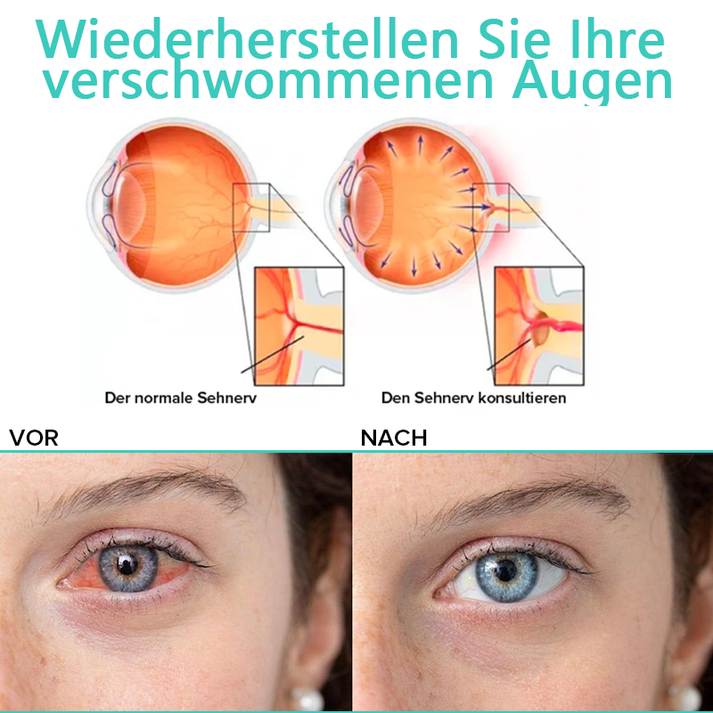 Schützende Augentropfen für Augenkomfort, reduzieren Rötungen und Trockenheit.
