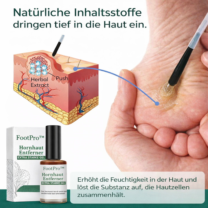 Ergebnis: Glatte Füße nach Anwendung des extra starken Hornhautentferner Gels für sanfte, schmerzfreie Hautpflege.