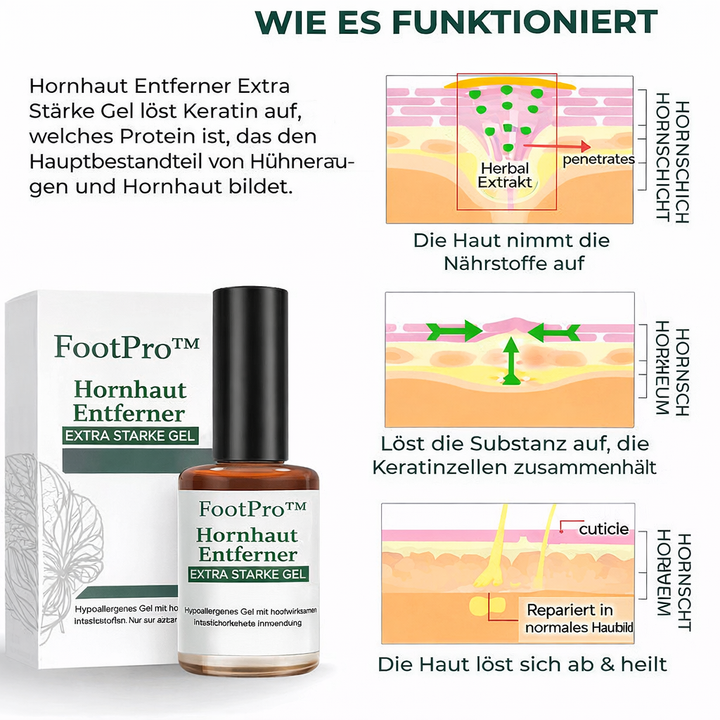 Hochwirksames Hornhautentferner Gel, extra stark, ideal für schnelle & schmerzfreie Entfernung von Hühneraugen & Schwielen.