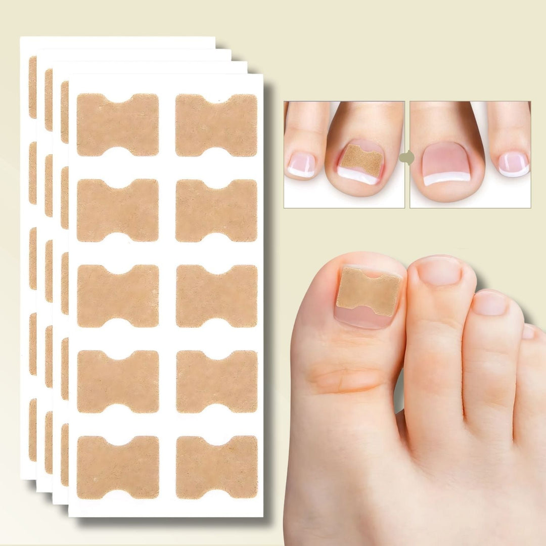 FixaNail Pflaster für eingewachsene Nägel, zeigt die innovative, schmerzfreie Nagelkorrektur & Linderung.