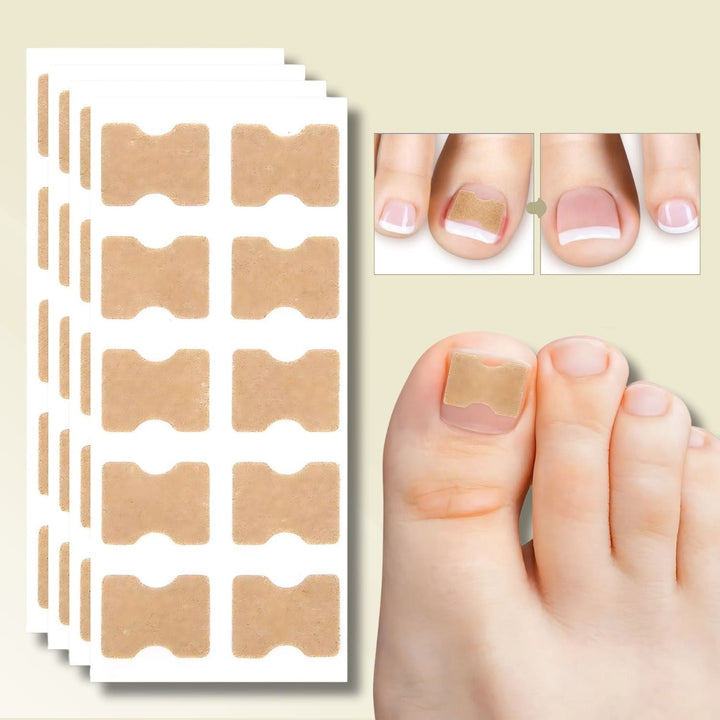 FixaNail Pflaster für eingewachsene Nägel, zeigt die innovative, schmerzfreie Nagelkorrektur & Linderung.
