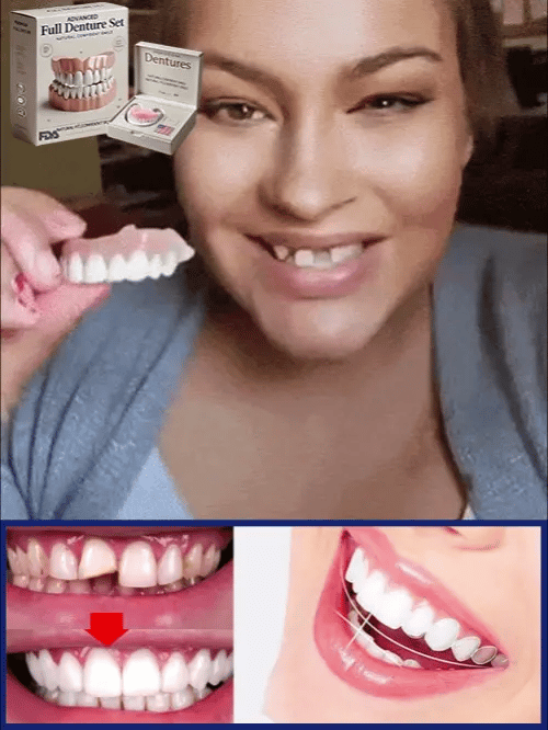 Komplette Zahnprothese: Flexibler Zahnersatz für Ober- und Unterkiefer für ein natürliches, schönes Lächeln.
