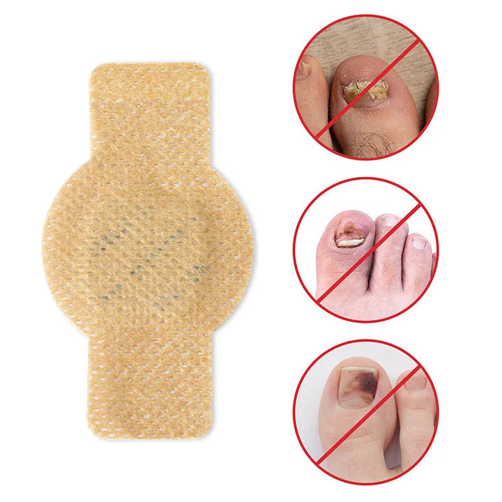 Effektive Nagelpilzbehandlung mit FungoStop Pflaster für sichtbar gesündere Nägel.