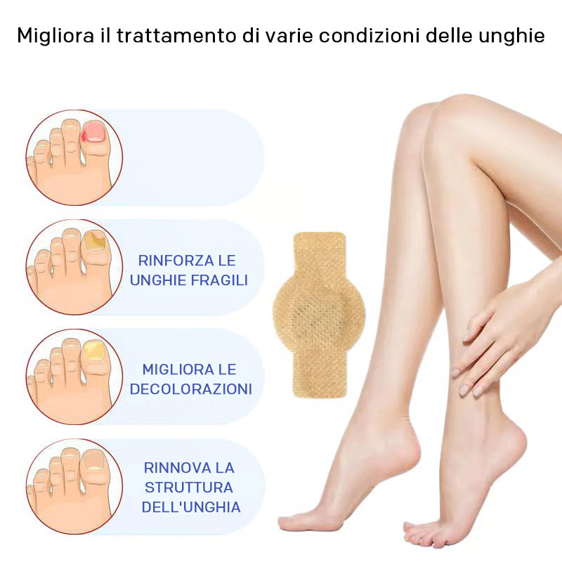 FungoStop Behandlungspflaster: Intensive Nagelregeneration und Schutz vor Nagelpilz.