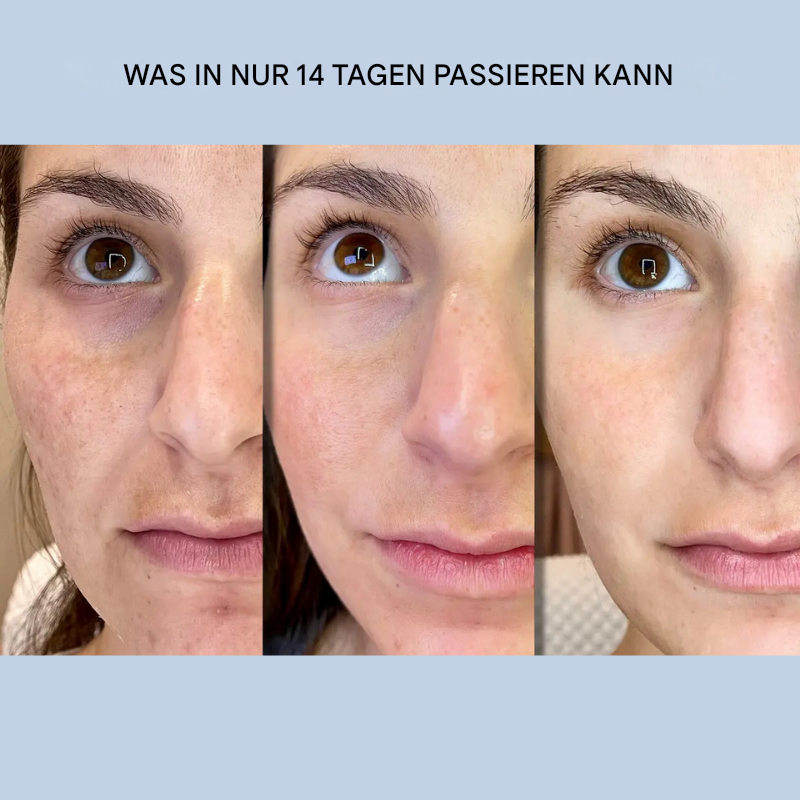 Unsichtbare Lifting-Streifen für eine natürliche Gesichtsstraffung und Anti-Falten-Wirkung.