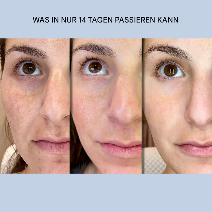 Unsichtbare Lifting-Streifen für eine natürliche Gesichtsstraffung und Anti-Falten-Wirkung.