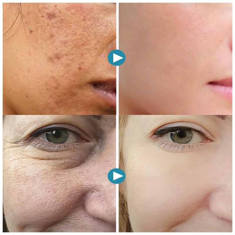 Dieser pflanzenbasierte Porenminimierer Primer sorgt sofort für glatte Haut. Die ideale kosmetische Makeup-Basis.