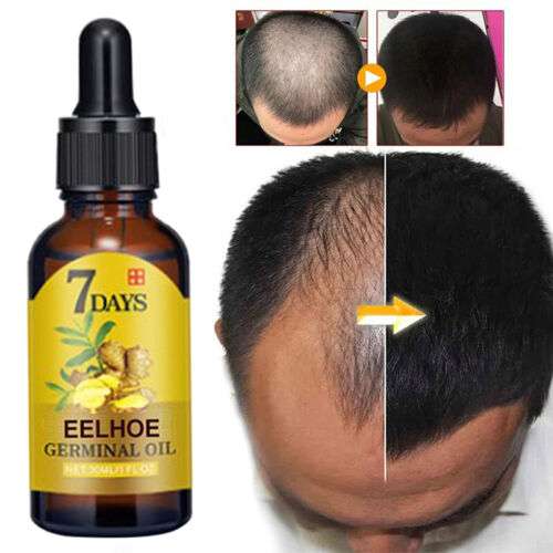 Haarwuchs Serum für kräftiges Haar bei Damen und Herren. Stärkt Kopfhaut & Wurzeln, reduziert Haarausfall.