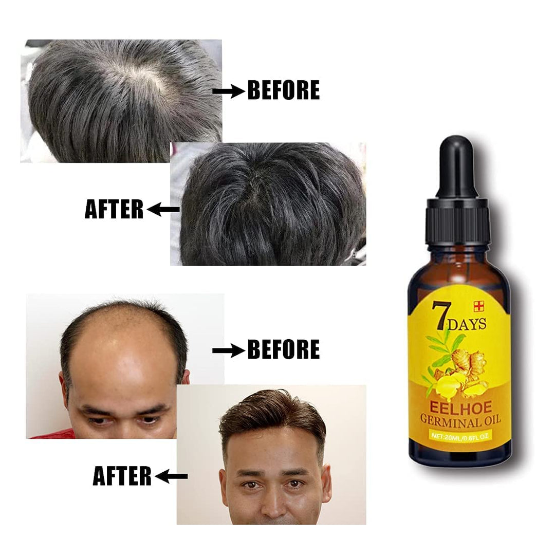 Flasche des Haarwuchs Serums für eine gesunde Kopfhautpflege. Fördert kräftiges Haarwachstum und Glanz.