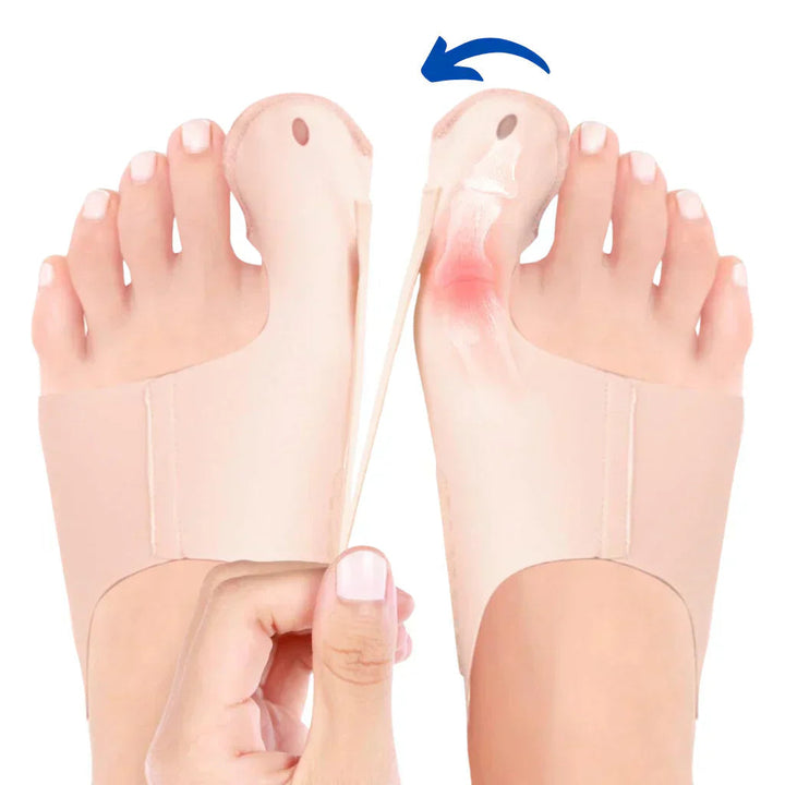 Diskrete Hallux Valgus Schiene für aktive Tage; unterstützt die Fußgesundheit & Zehenkorrektur.
