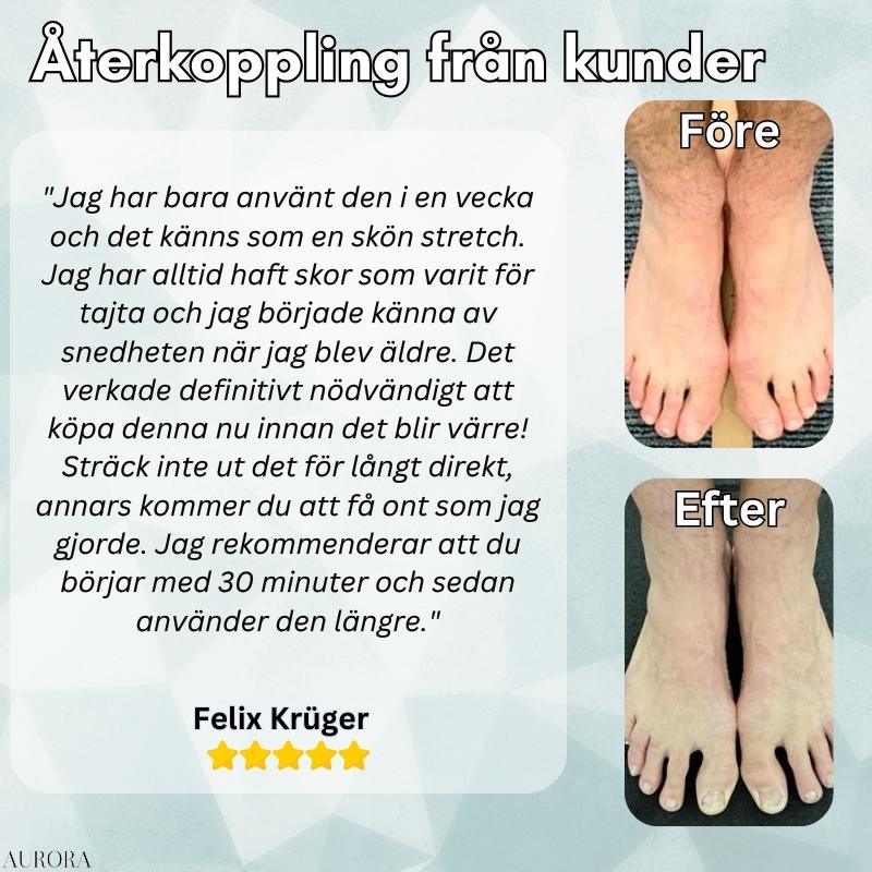 Hallux Valgus Korrektor: Orthopädische Unterstützung für Großzehe und Fußkomfort.