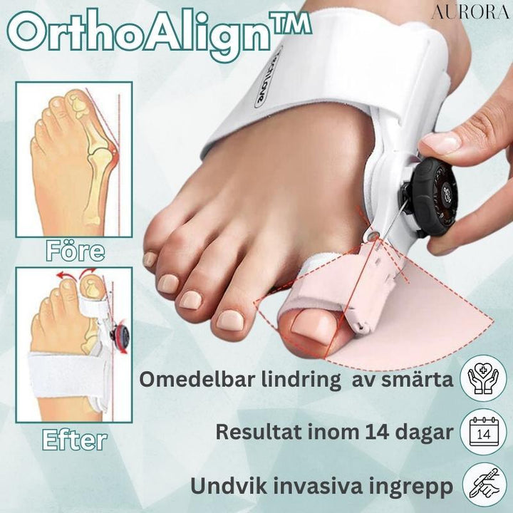 Orthopädische Hallux Valgus Korrekturschiene zur Linderung von Fußschmerzen.