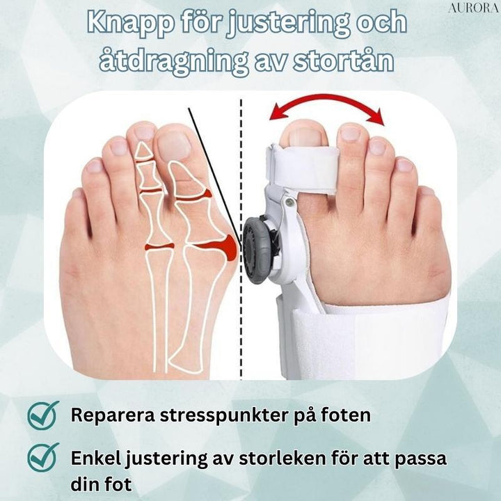 Medizinischer Zehenkorrektor: Hallux Valgus Schiene für verbesserte Fußhaltung.