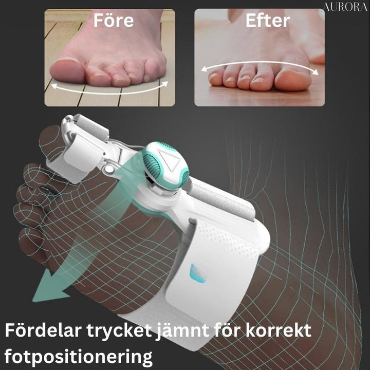 Die Korrekturschiene unterstützt die natürliche Ausrichtung der Zehen bei Hallux Valgus.