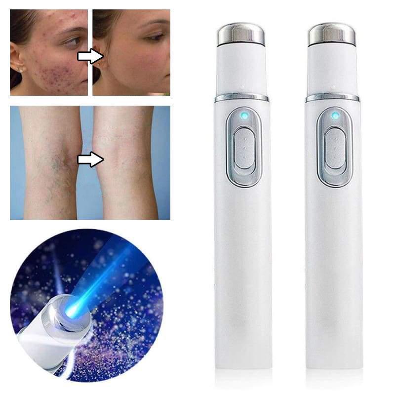 Person wendet Blaulicht-Laser-Stift gegen Akne im Gesicht an. Für eine Porenverfeinerung & Hautreinigung.