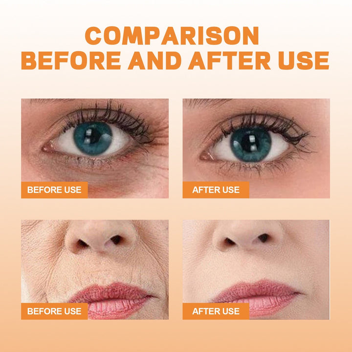 Effektive Anti-Aging Kollagenmaske zur Faltenreduktion & Hautstraffung. 10 Stück für jugendliches Hautbild.