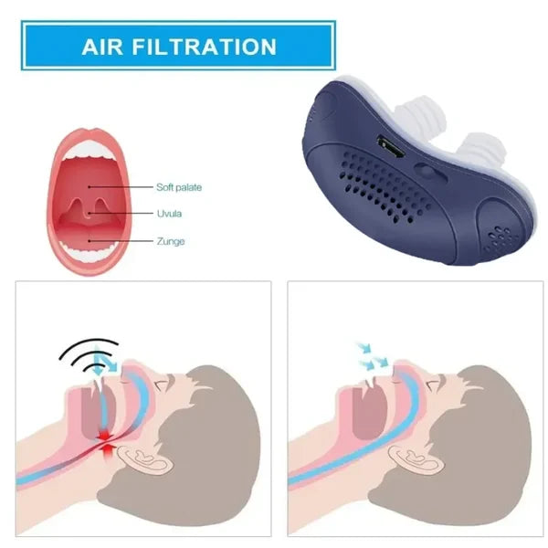 Dieses Micro-CPAP Gerät bekämpft Schnarchen effektiv. Genießen Sie geräuschlosen, tiefen und gesunden Schlaf.