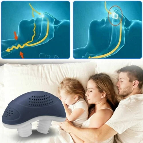 Kompaktes Micro-CPAP Gerät für unterwegs. Effektive Anti-Schnarch Lösung für geräuschlose Nächte.